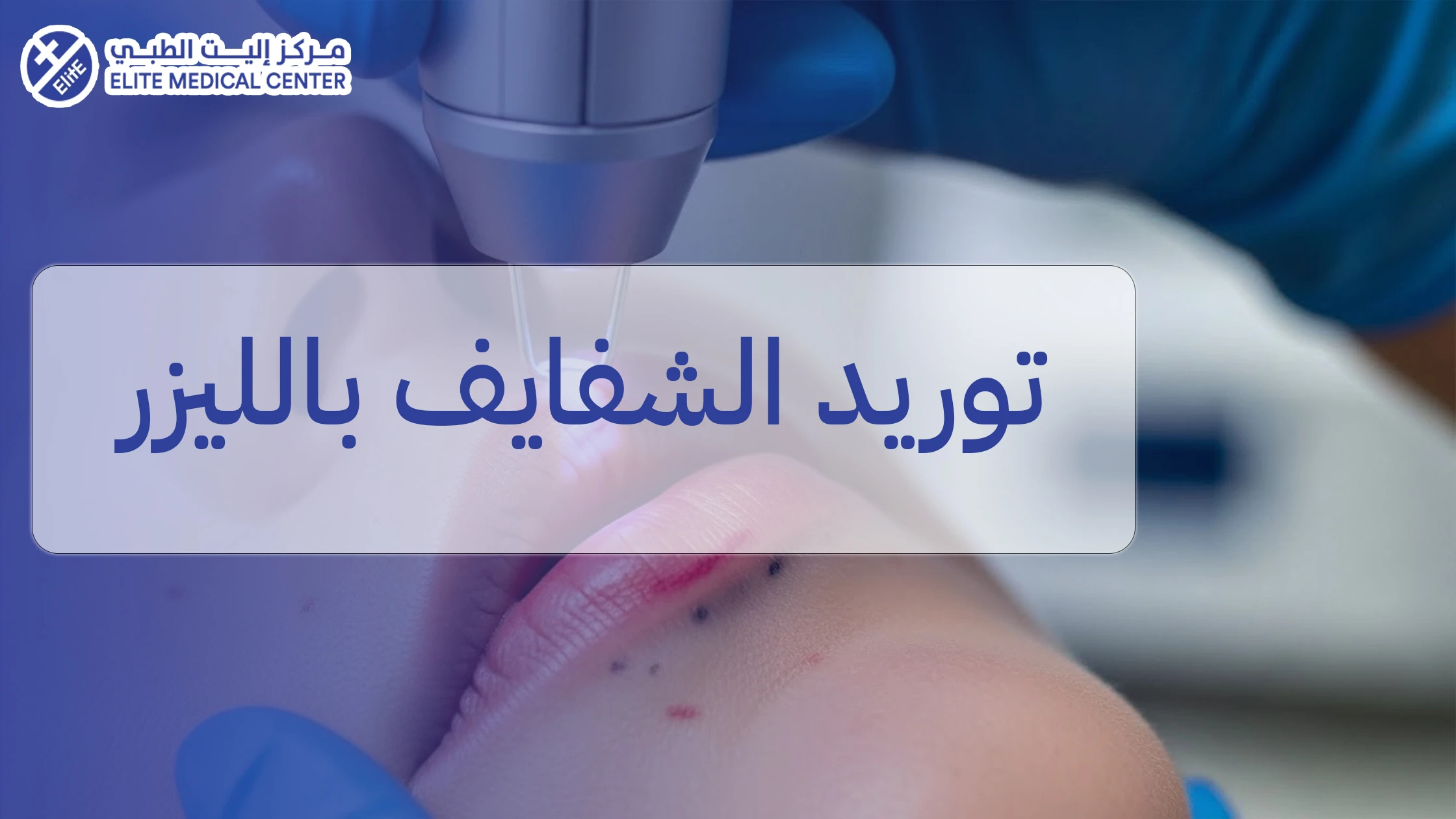 توريد الشفايف بالليزر: الحقيقة الطبية، النتائج المتوقعة، وحدود العلاج