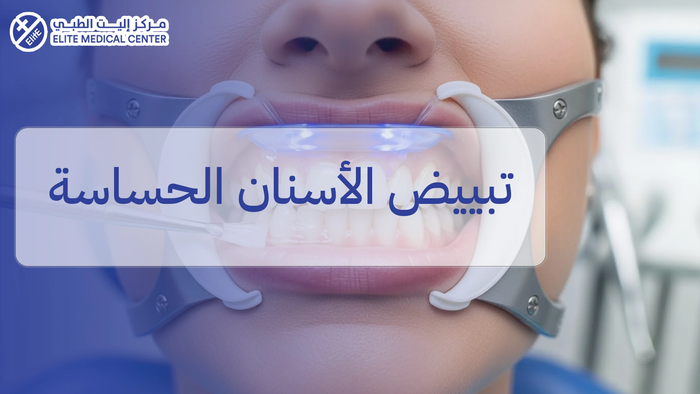 تبييض الأسنان الحساسة: كيف يتم بأمان دون زيادة الألم؟